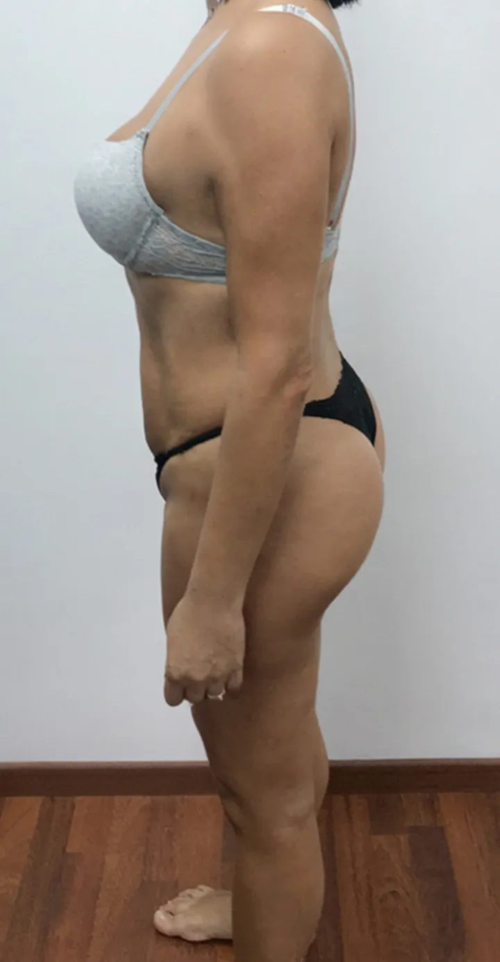 Amaia ahora